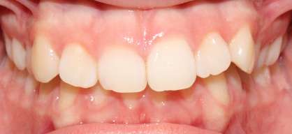 Before image
