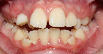 Before image
