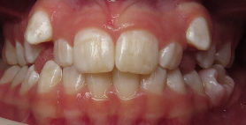Before image