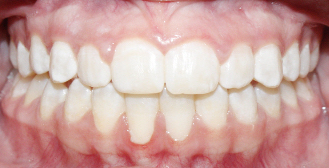 After image