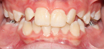Before image