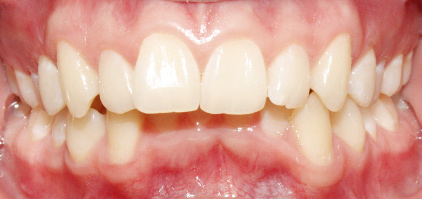 Before image