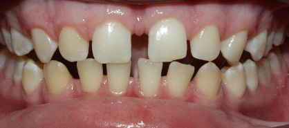 Before image