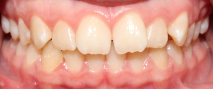 Before image