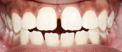 Before image