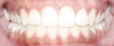 After image